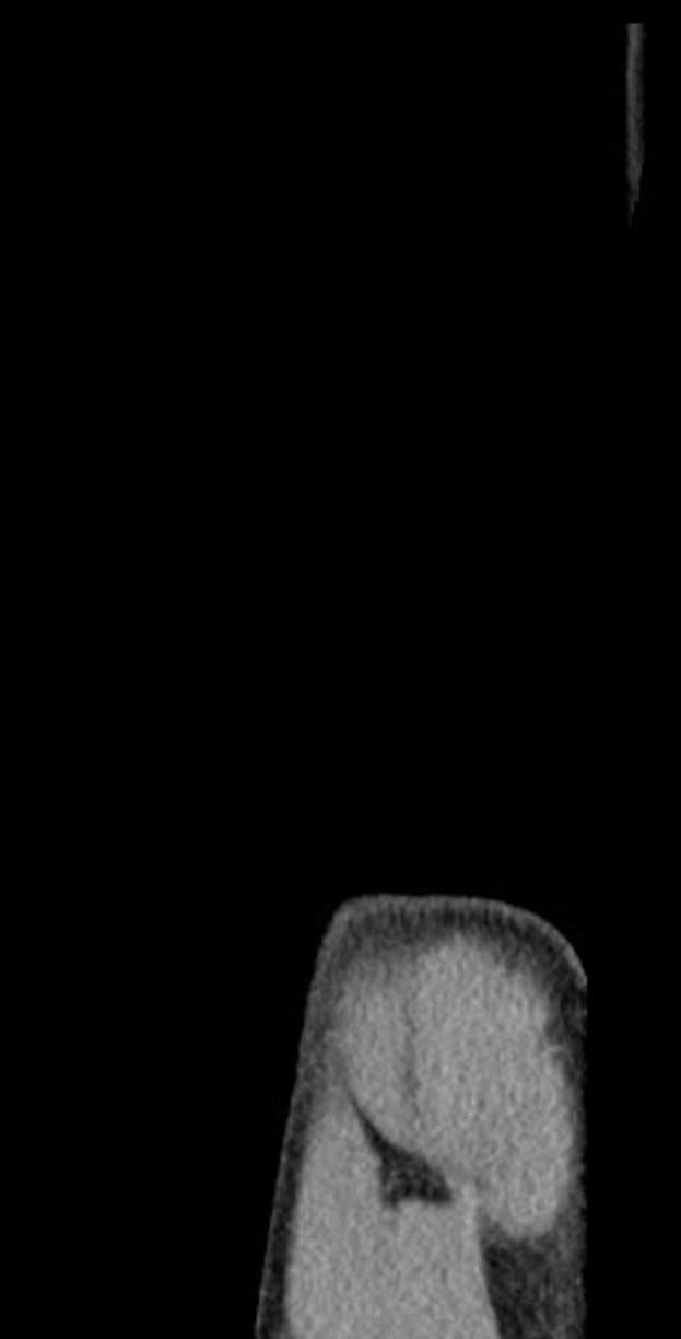 Schwarze und weiße MRI-Aufnahme eines Knies, die detaillierte innere Anatomie zeigt.